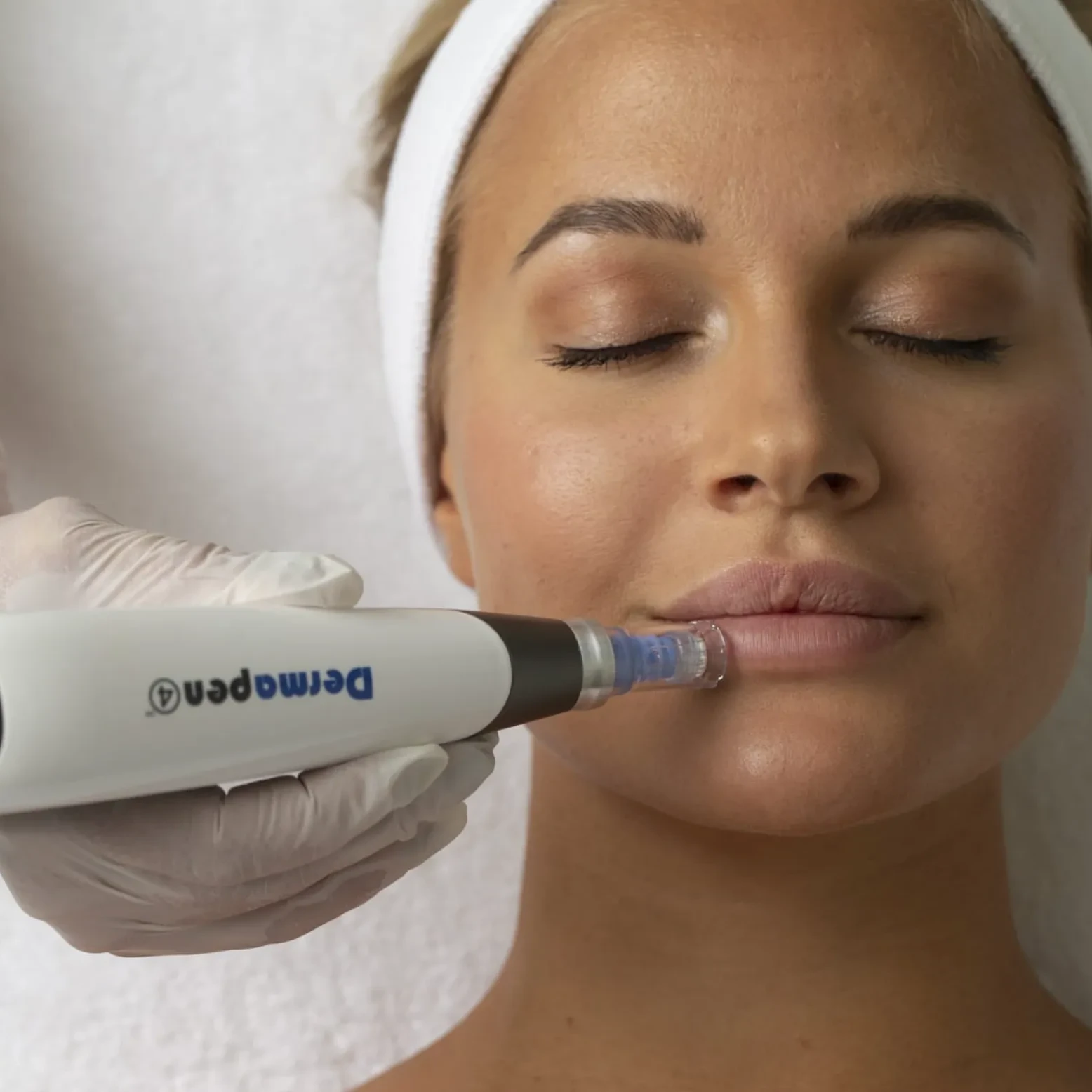 Dermapen microneedling-behandling